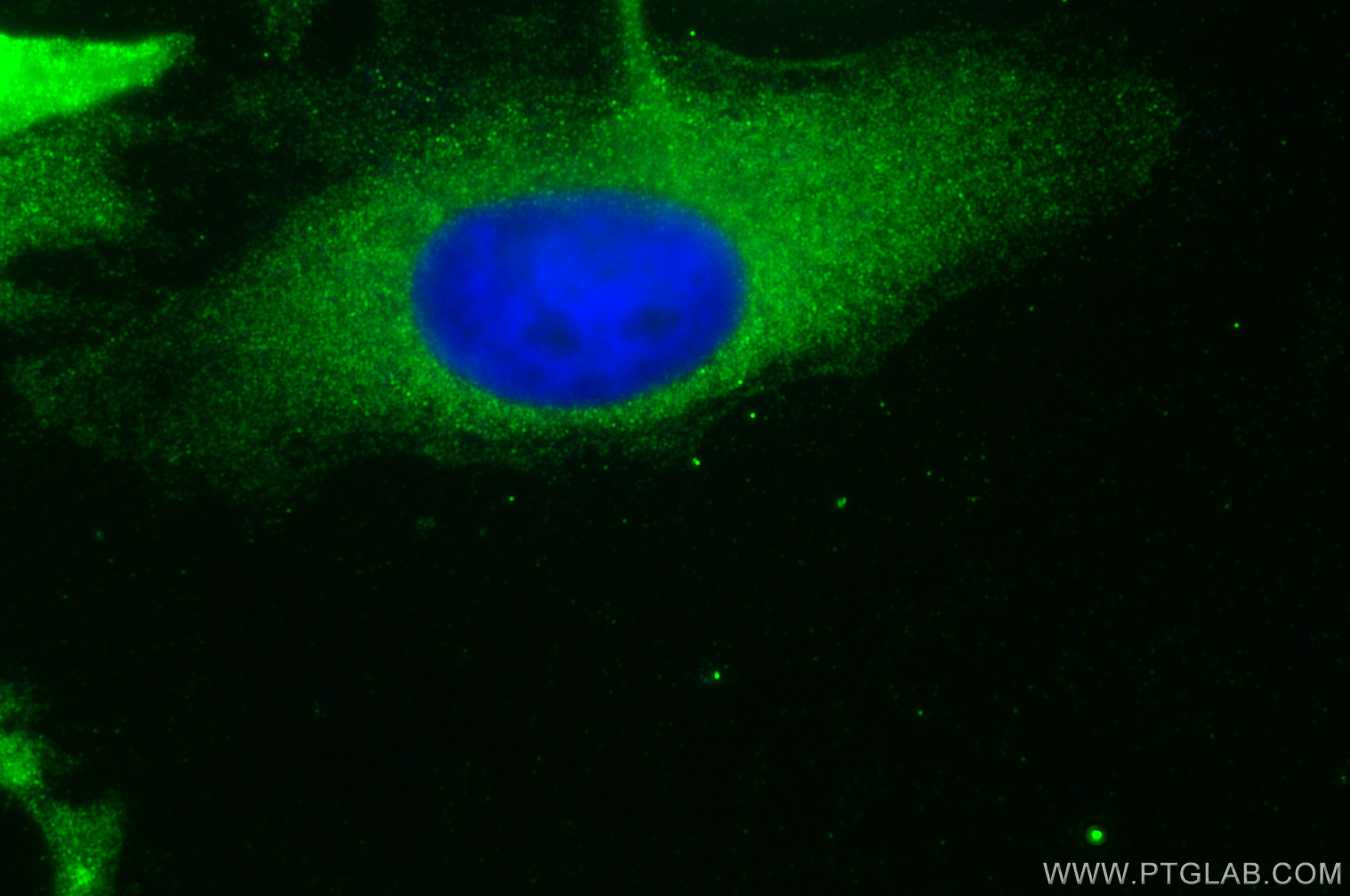 Immunofluorescence (IF) / fluorescent staining of HeLa cells using NAGK Polyclonal antibody (15051-1-AP)