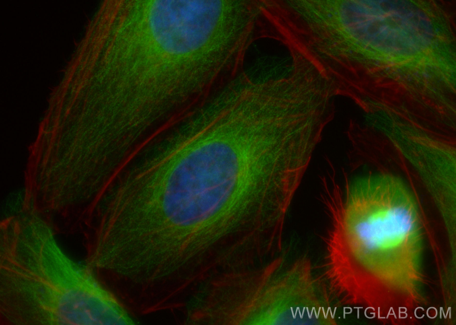 Immunofluorescence (IF) / fluorescent staining of HeLa cells using NAP1L1 Polyclonal antibody (14898-1-AP)