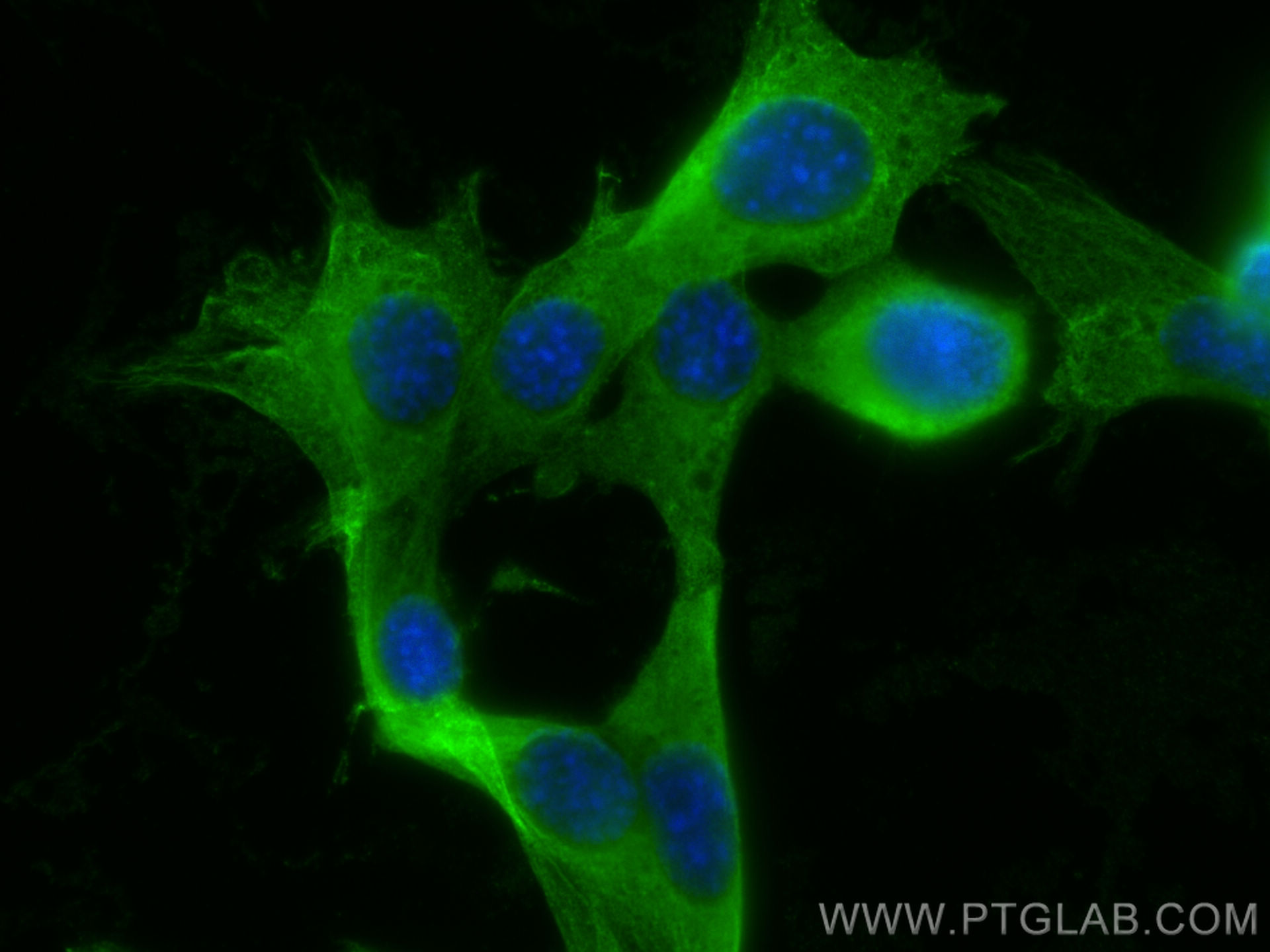 Immunofluorescence (IF) / fluorescent staining of NIH/3T3 cells using NAP1L1 Polyclonal antibody (14898-1-AP)