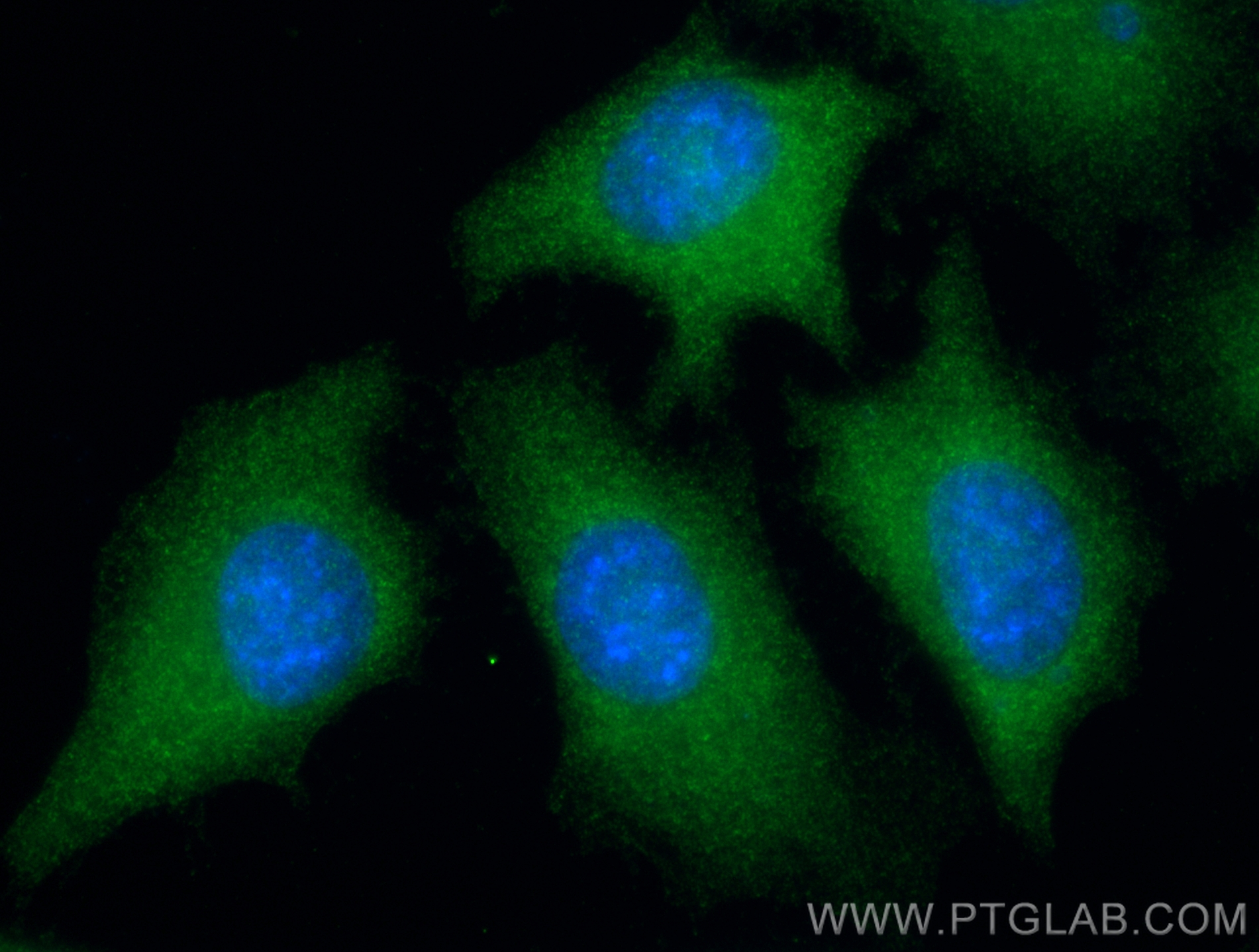 Immunofluorescence (IF) / fluorescent staining of HeLa cells using NAPRT1 Monoclonal antibody (66159-1-Ig)