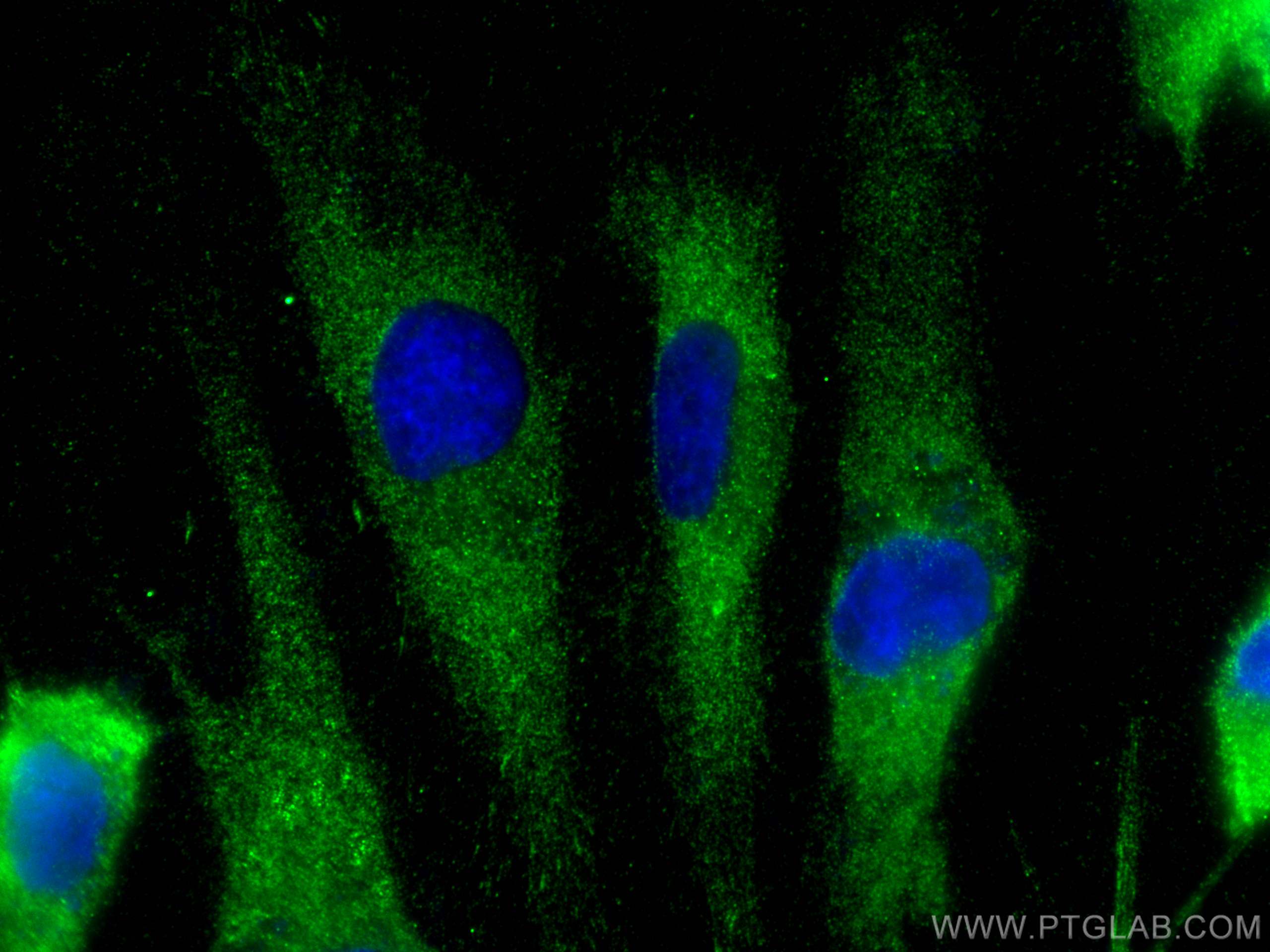 Immunofluorescence (IF) / fluorescent staining of HUVEC cells using Napsin A Polyclonal antibody (16558-1-AP)