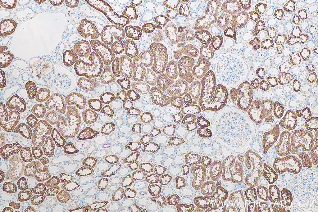 Immunohistochemistry (IHC) staining of human kidney tissue using Napsin A Monoclonal antibody (60259-2-Ig)