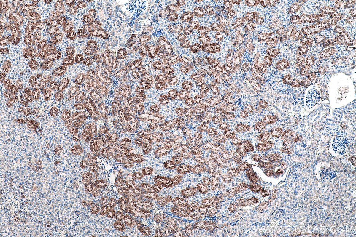Immunohistochemistry (IHC) staining of mouse kidney tissue using Napsin A Monoclonal antibody (60259-2-Ig)