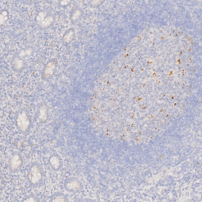 Immunohistochemistry (IHC) staining of human appendicitis tissue using Napsin A Monoclonal antibody (60259-2-Ig)