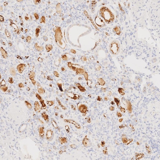 Immunohistochemistry (IHC) staining of human kidney tissue using Napsin A Monoclonal antibody (60259-2-Ig)