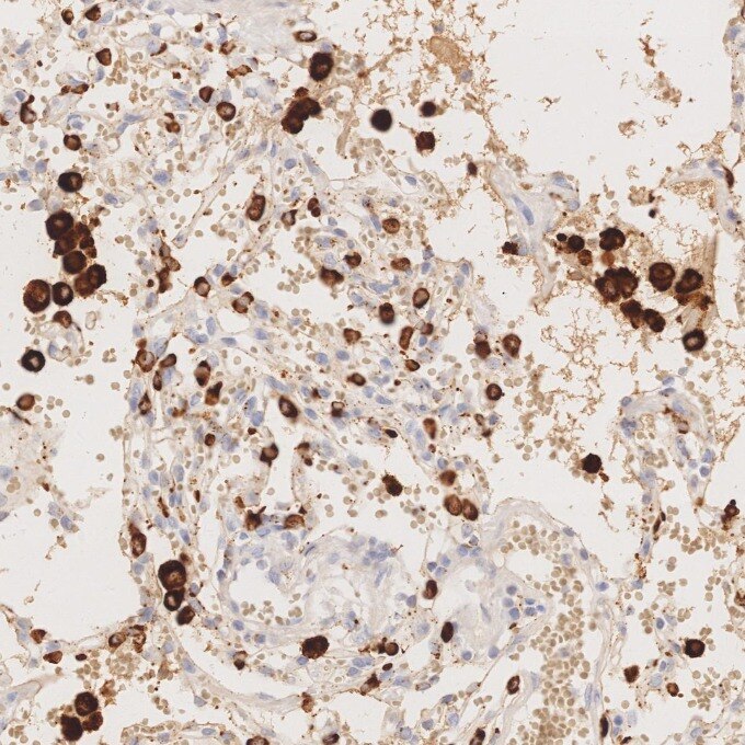 Immunohistochemistry (IHC) staining of human lung tissue using Napsin A Monoclonal antibody (60259-2-Ig)