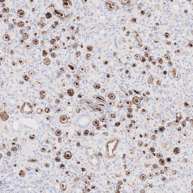 Immunohistochemistry (IHC) staining of human kidney tissue using Napsin A Monoclonal antibody (60259-2-Ig)
