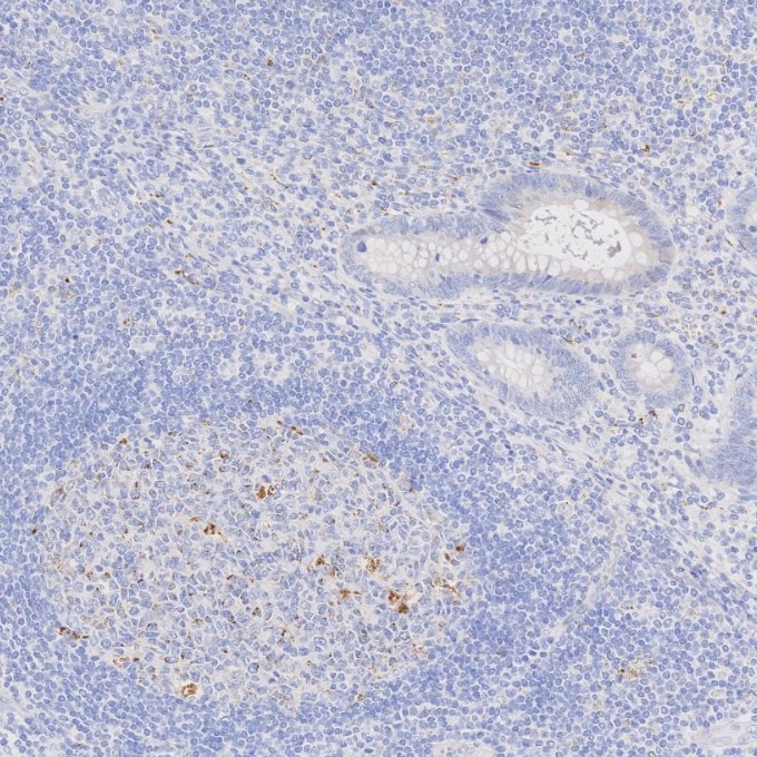 Immunohistochemistry (IHC) staining of human appendicitis tissue using Napsin A Monoclonal antibody (60259-2-Ig)
