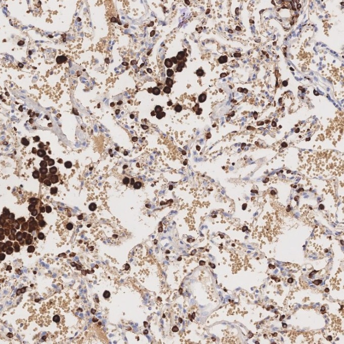 Immunohistochemistry (IHC) staining of human lung tissue using Napsin A Monoclonal antibody (60259-2-Ig)