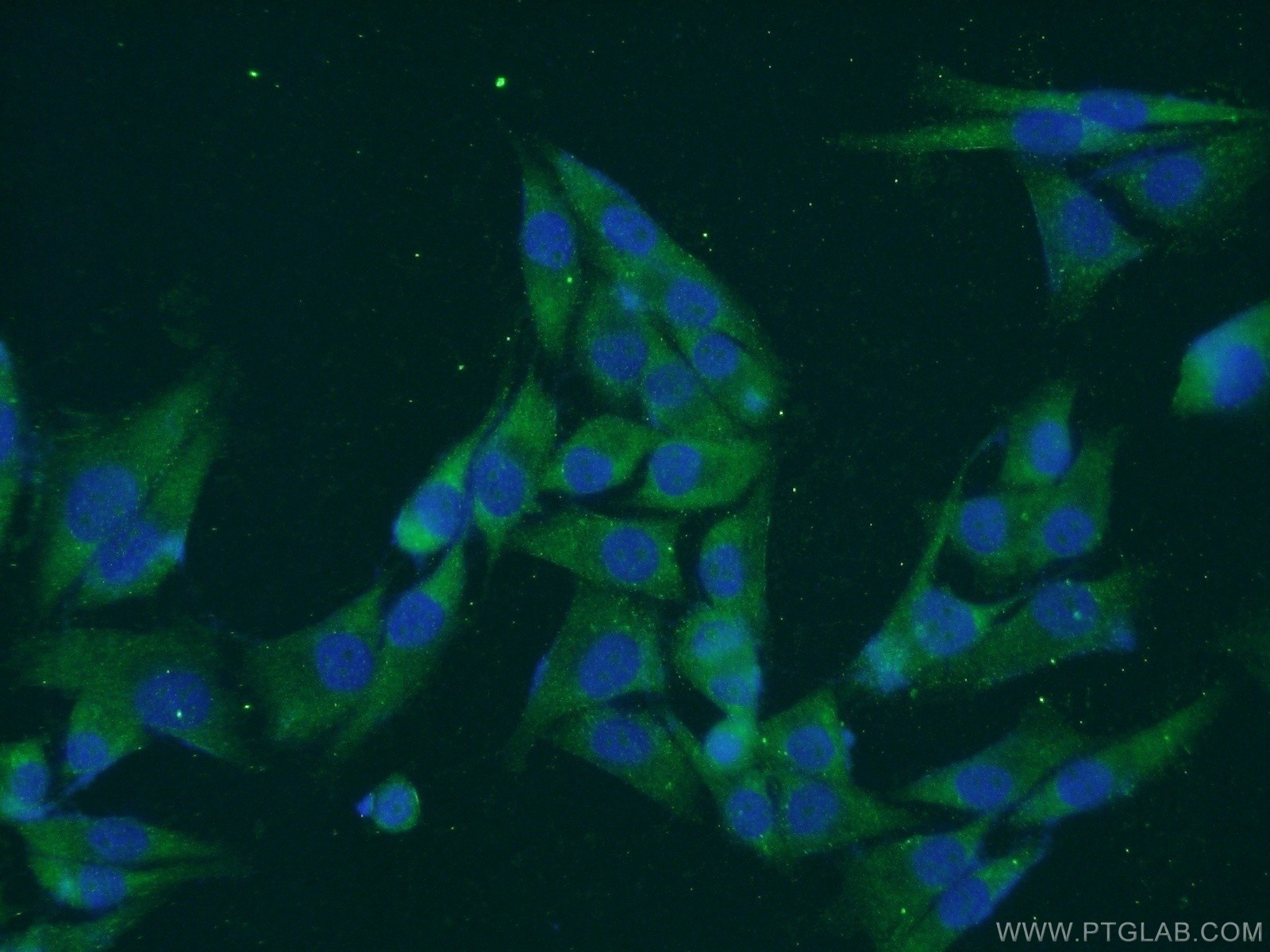 Immunofluorescence (IF) / fluorescent staining of A375 cells using NAT1 Polyclonal antibody (14394-1-AP)