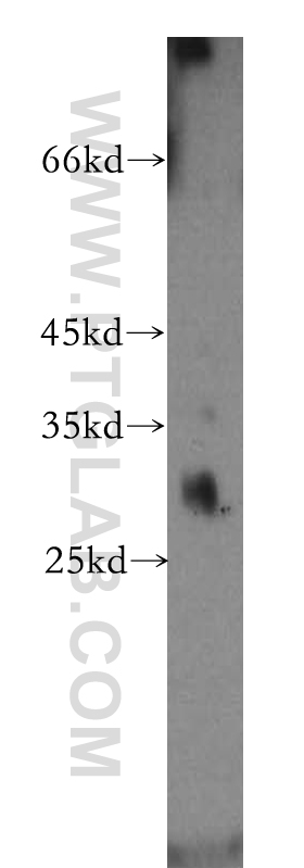 Western Blot (WB) analysis of PC-3 cells using NAT1 Polyclonal antibody (14394-1-AP)