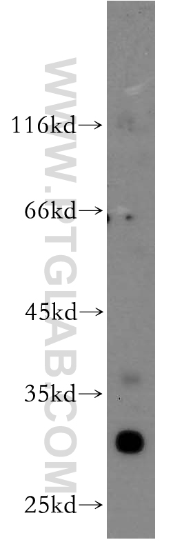 Western Blot (WB) analysis of A375 cells using NAT1 Polyclonal antibody (14394-1-AP)