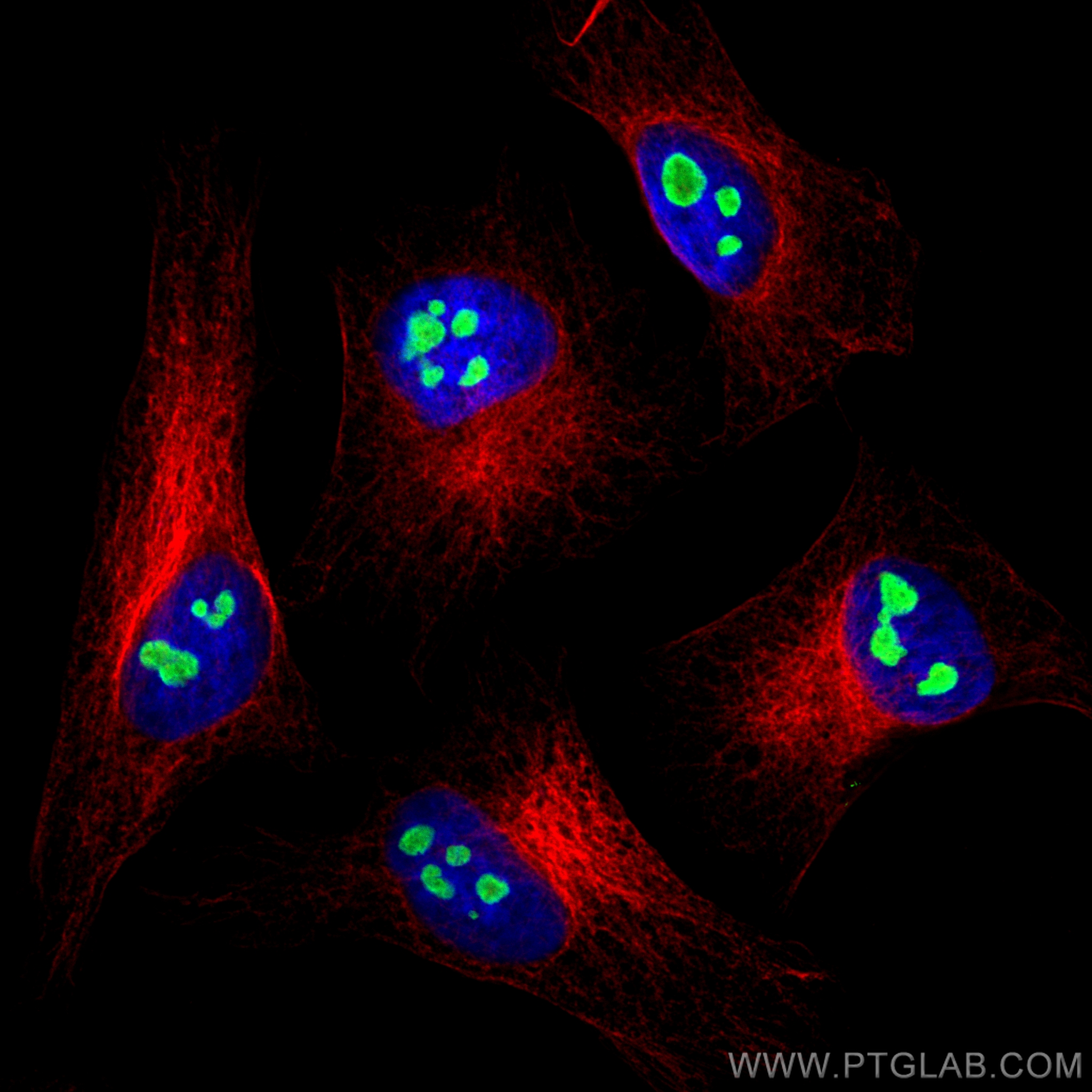 Immunofluorescence (IF) / fluorescent staining of HeLa cells using NAT10 Polyclonal antibody (13365-1-AP)