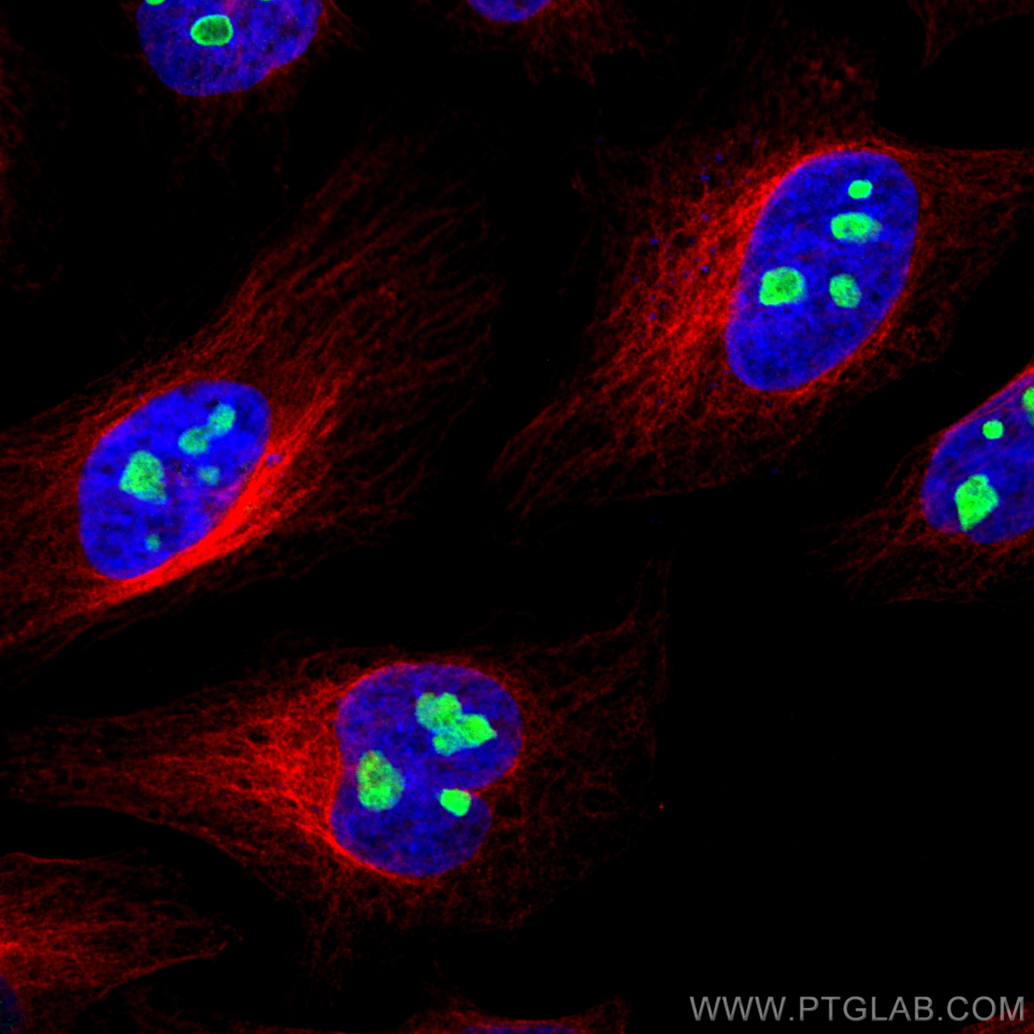 Immunofluorescence (IF) / fluorescent staining of HeLa cells using NAT10 Recombinant antibody (82585-1-RR)