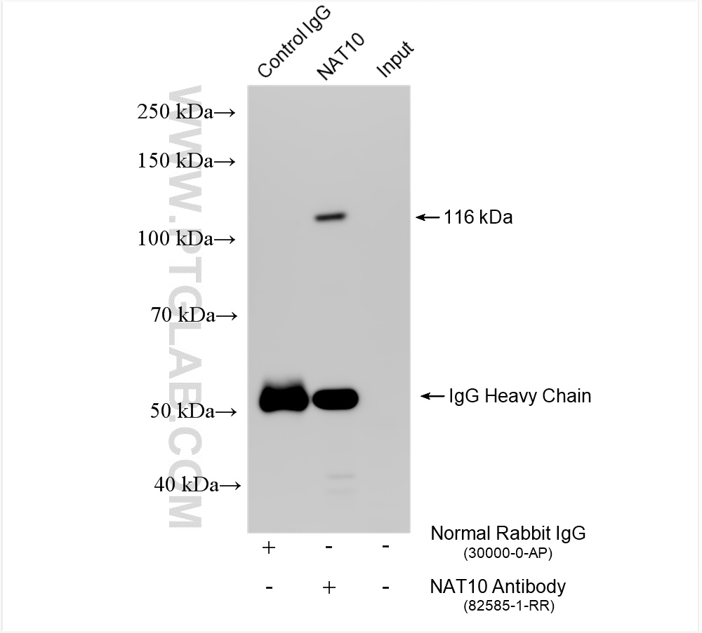 Immunoprecipitation (IP) experiment of mouse testis tissue using NAT10 Recombinant antibody (82585-1-RR)