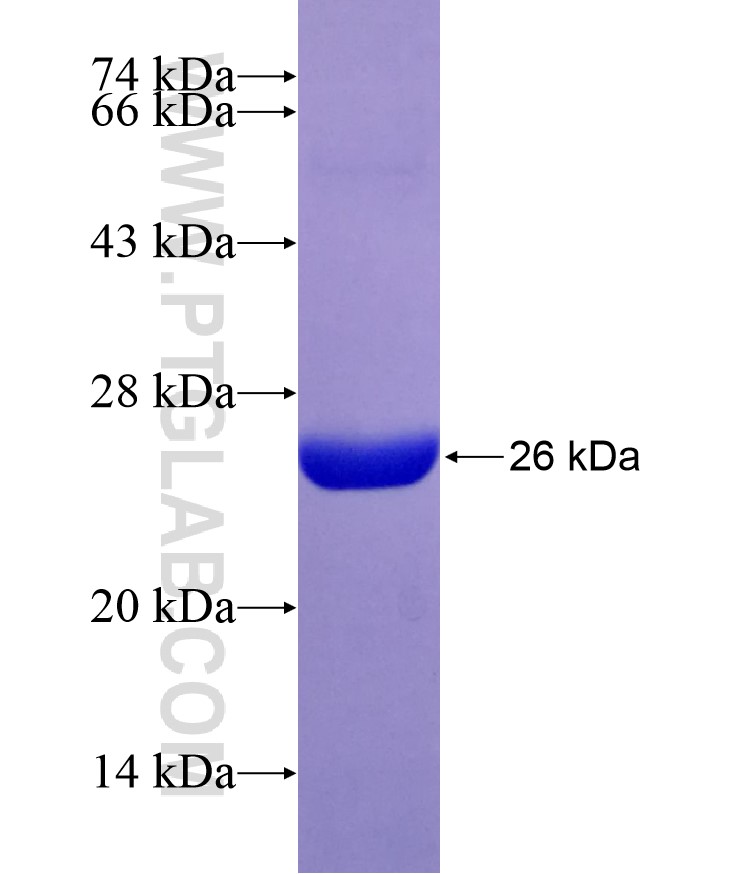 NAT15 fusion protein Ag29322 SDS-PAGE