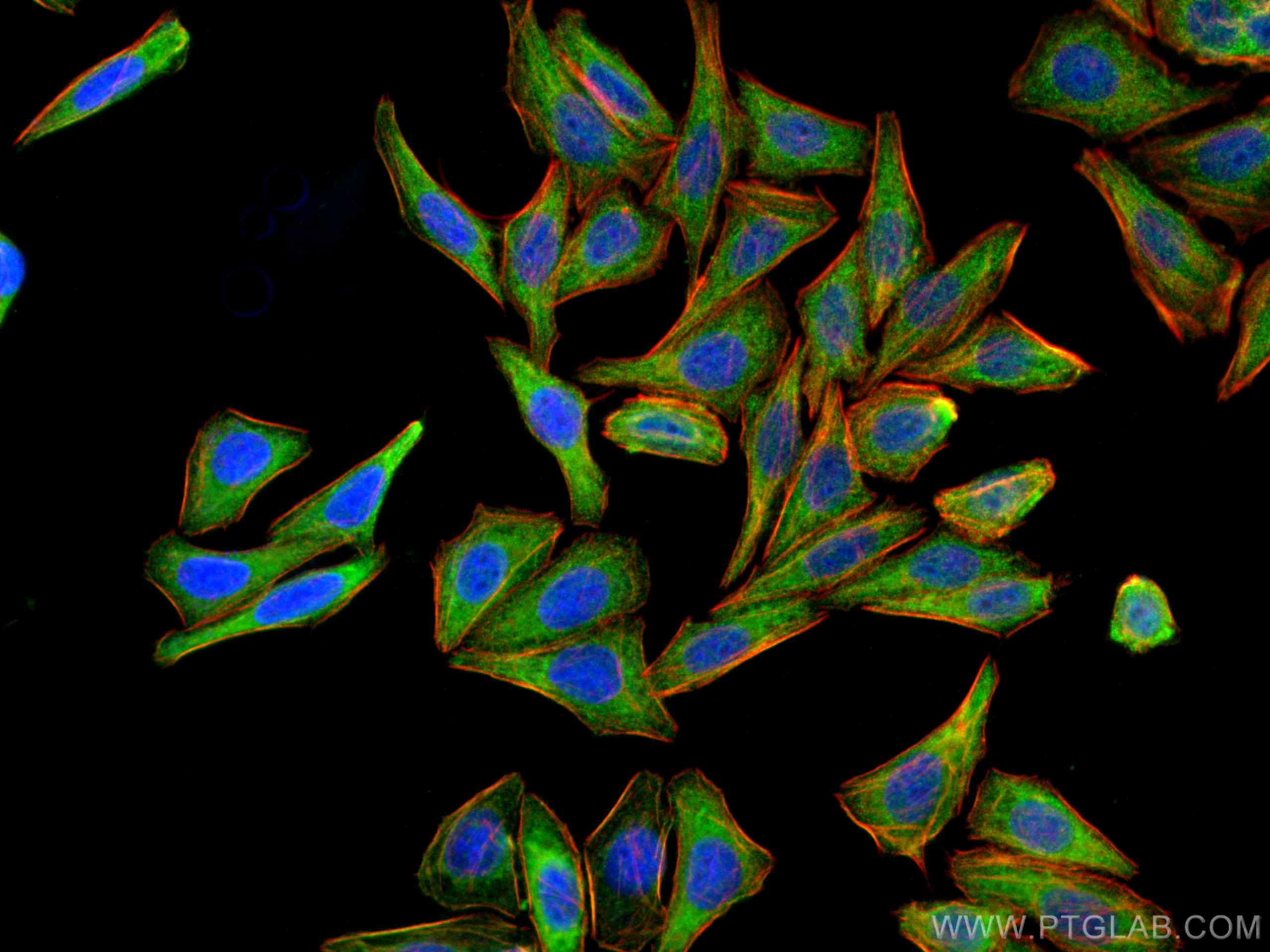 Immunofluorescence (IF) / fluorescent staining of HepG2 cells using NBCe2 Polyclonal antibody (26150-1-AP)