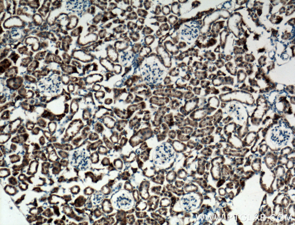 Immunohistochemistry (IHC) staining of mouse kidney tissue using NBCe2 Polyclonal antibody (26150-1-AP)