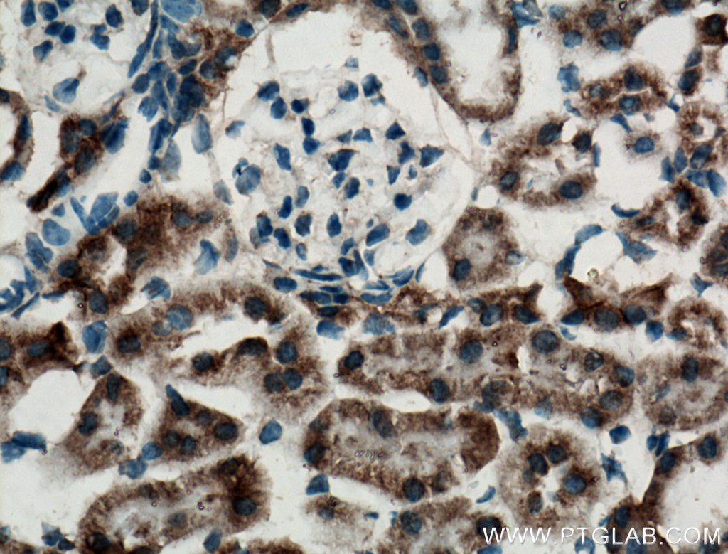 Immunohistochemistry (IHC) staining of mouse kidney tissue using NBCe2 Polyclonal antibody (26150-1-AP)