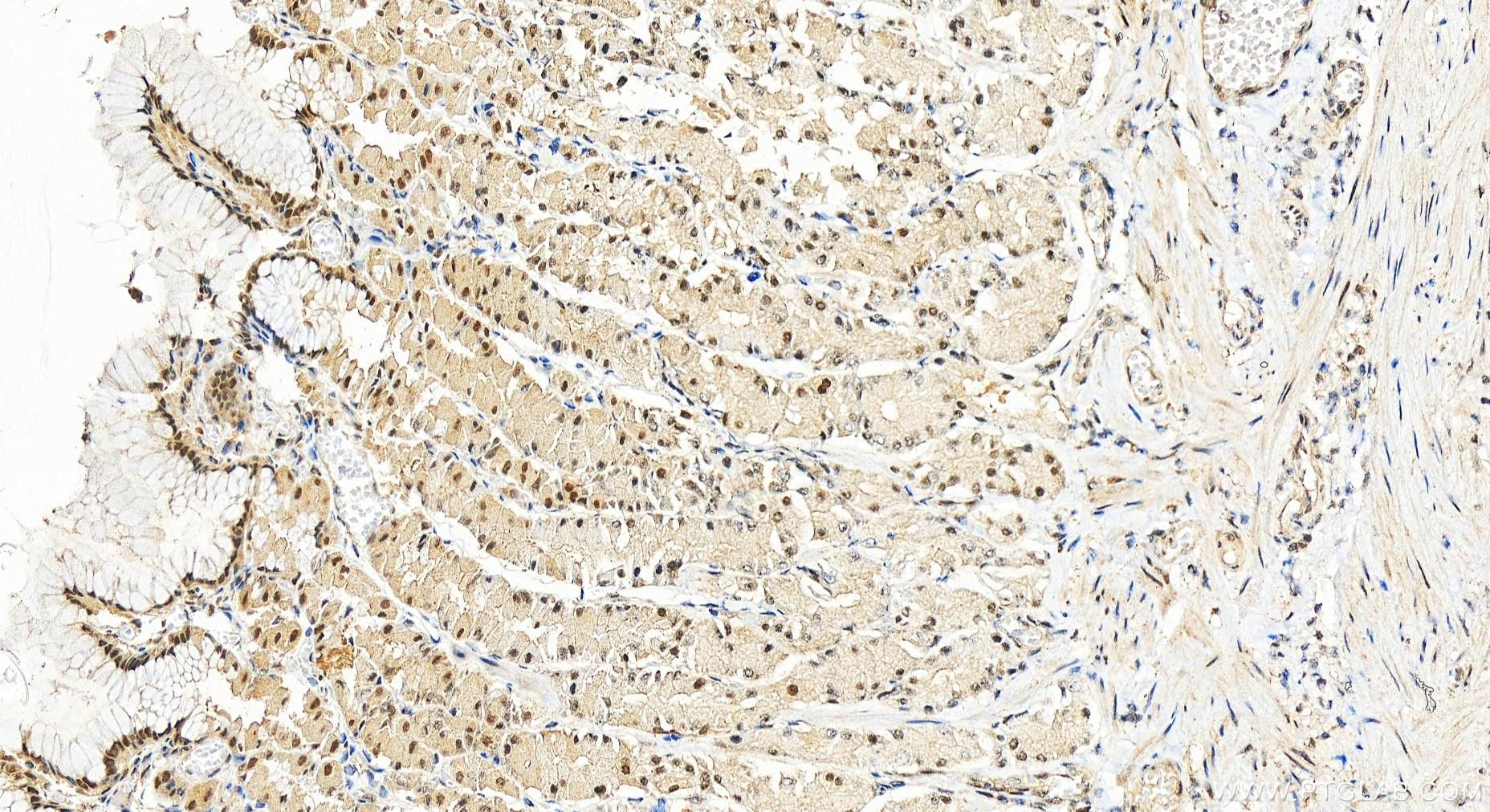 Immunohistochemistry (IHC) staining of human stomach tissue using NBN / NBS1 Polyclonal antibody (55025-1-AP)