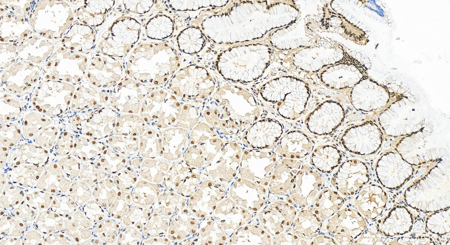 Immunohistochemistry (IHC) staining of human stomach tissue using NBN / NBS1 Polyclonal antibody (55025-1-AP)