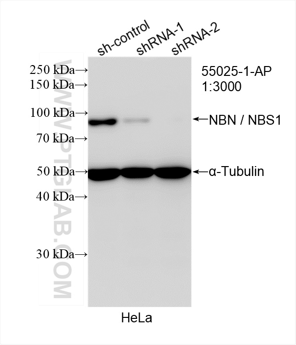 Western Blot (WB) analysis of HeLa cells using NBN / NBS1 Polyclonal antibody (55025-1-AP)