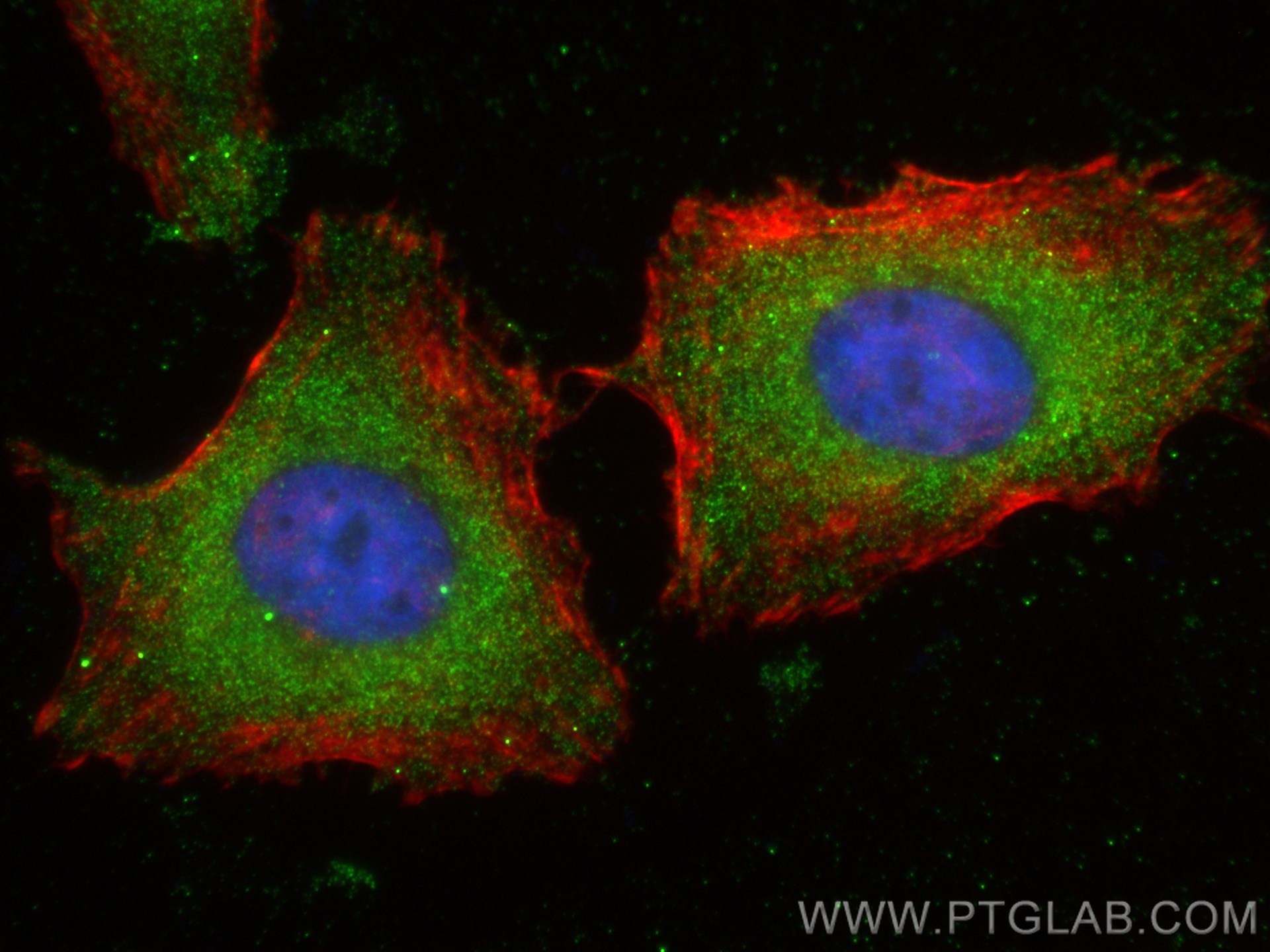 Immunofluorescence (IF) / fluorescent staining of HeLa cells using CoraLite® Plus 488-conjugated NBR1 Monoclonal anti (CL488-68062)