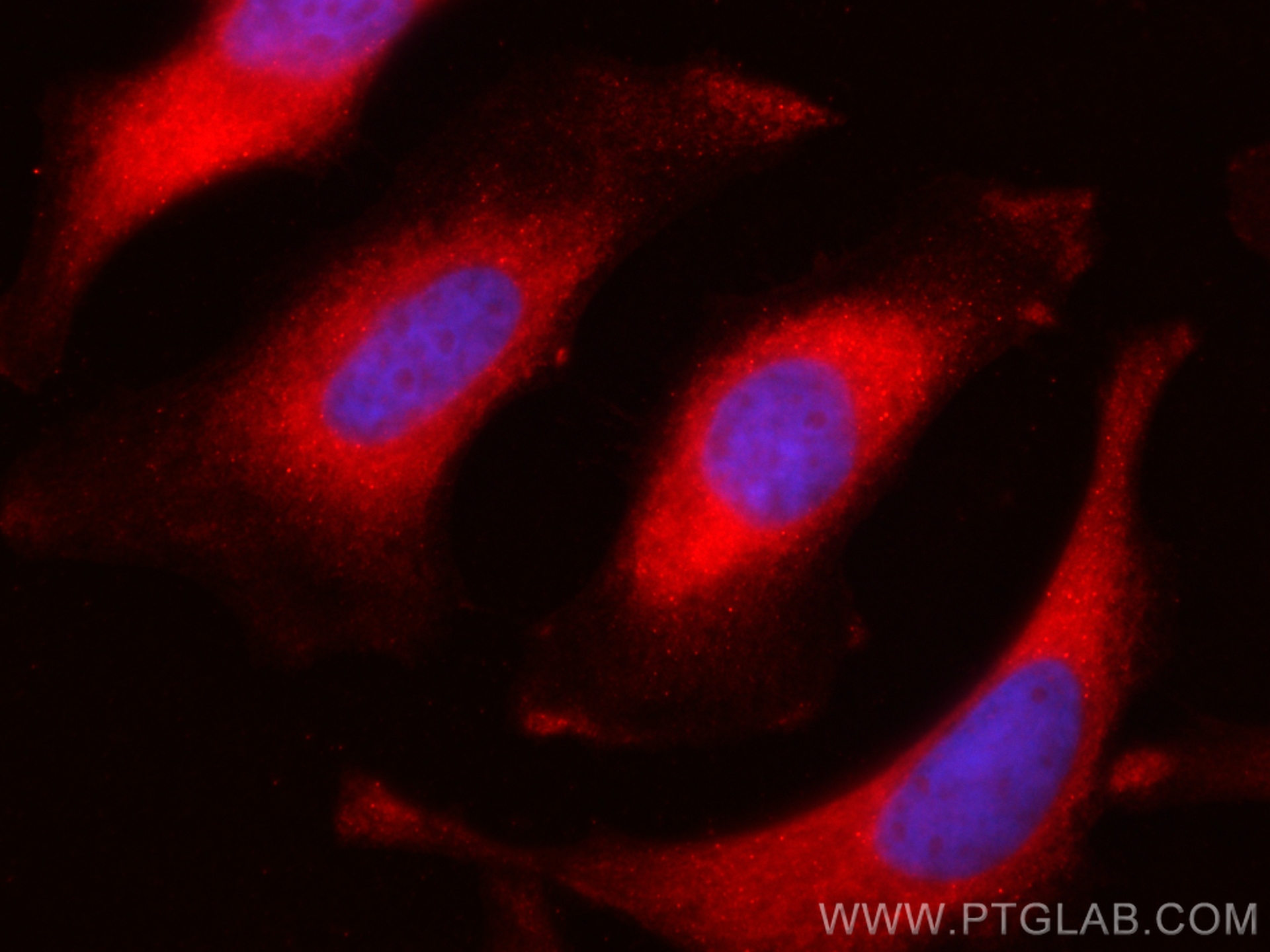 Immunofluorescence (IF) / fluorescent staining of HeLa cells using CoraLite®594-conjugated NBR1 Polyclonal antibody (CL594-16004)