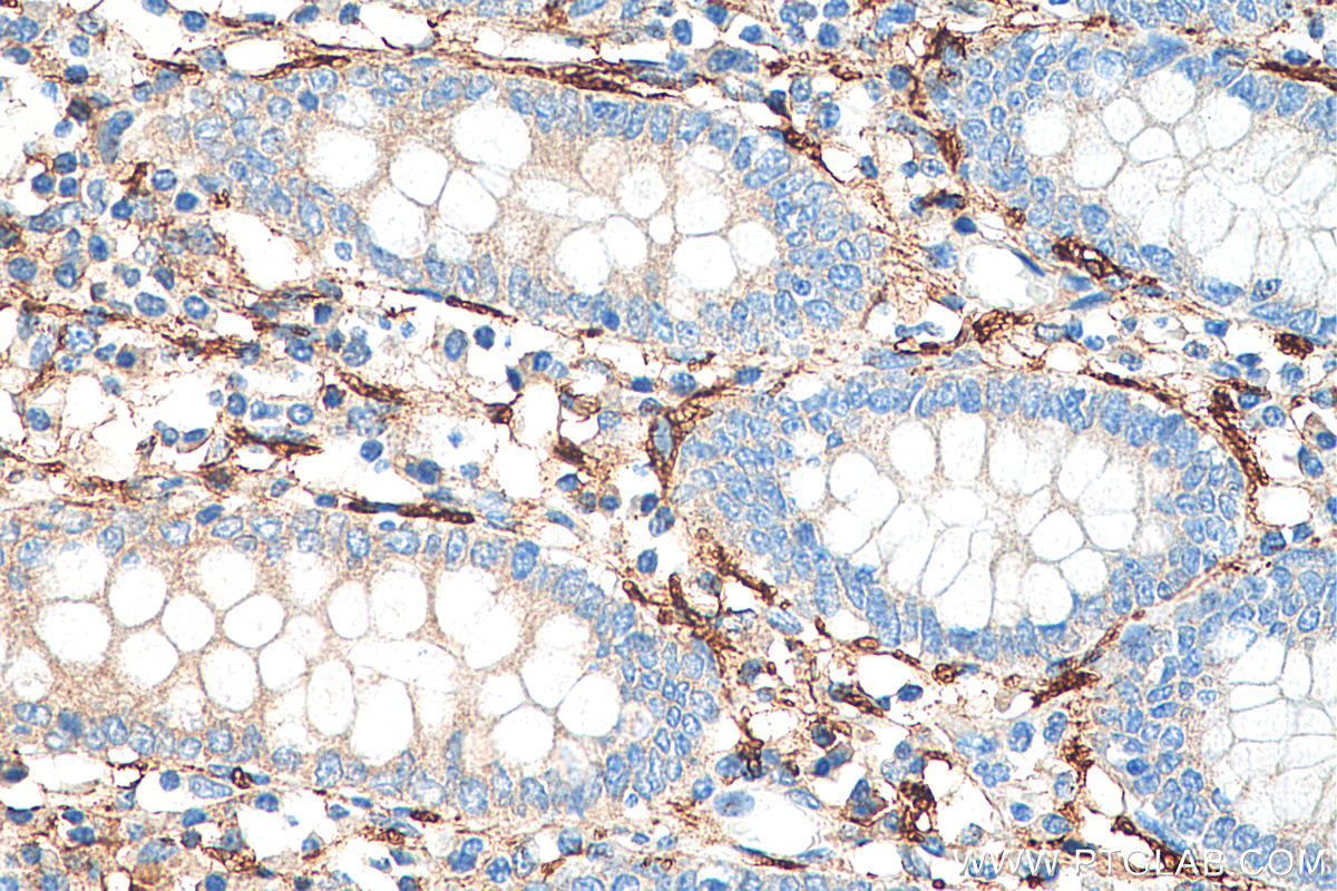 Immunohistochemistry (IHC) staining of human colon tissue using NCAM1/CD56 Polyclonal antibody (14255-1-AP)