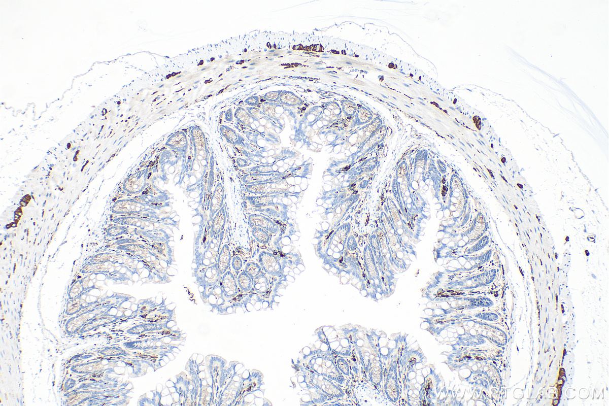 Immunohistochemistry (IHC) staining of mouse colon tissue using NCAM1/CD56 Polyclonal antibody (14255-1-AP)