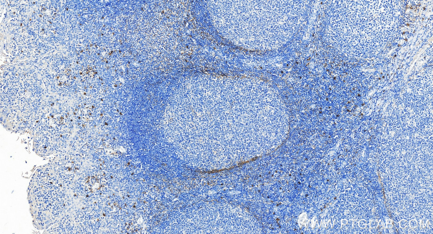 Immunohistochemistry (IHC) staining of human tonsillitis tissue using NCAM1/CD56 Polyclonal antibody (14255-1-AP)