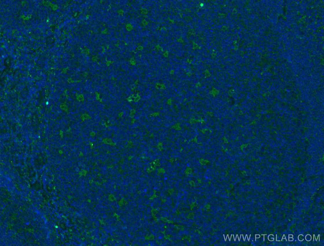 Immunofluorescence (IF) / fluorescent staining of human tonsillitis tissue using NCAM1/CD56 Monoclonal antibody (60238-1-Ig)