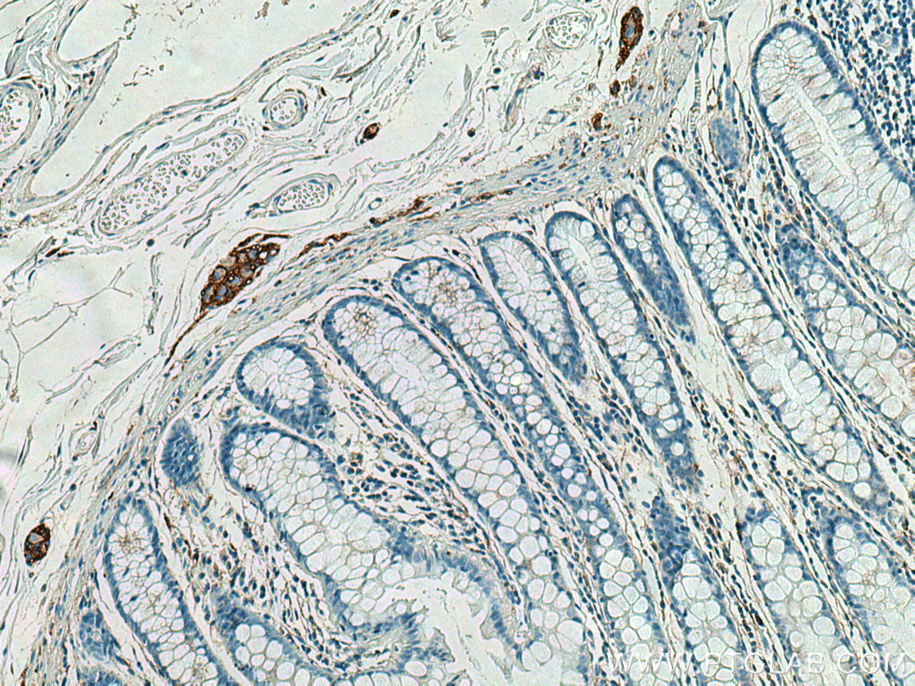 Immunohistochemistry (IHC) staining of human colon tissue using NCAM1/CD56 Monoclonal antibody (60238-1-Ig)