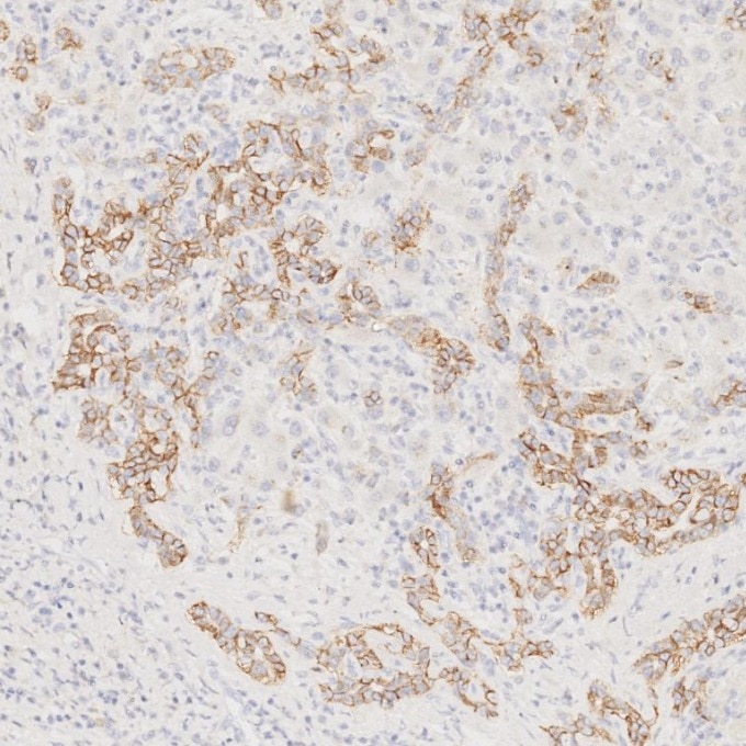 Immunohistochemistry (IHC) staining of human liver tissue using NCAM1/CD56 Monoclonal antibody (60238-1-Ig)