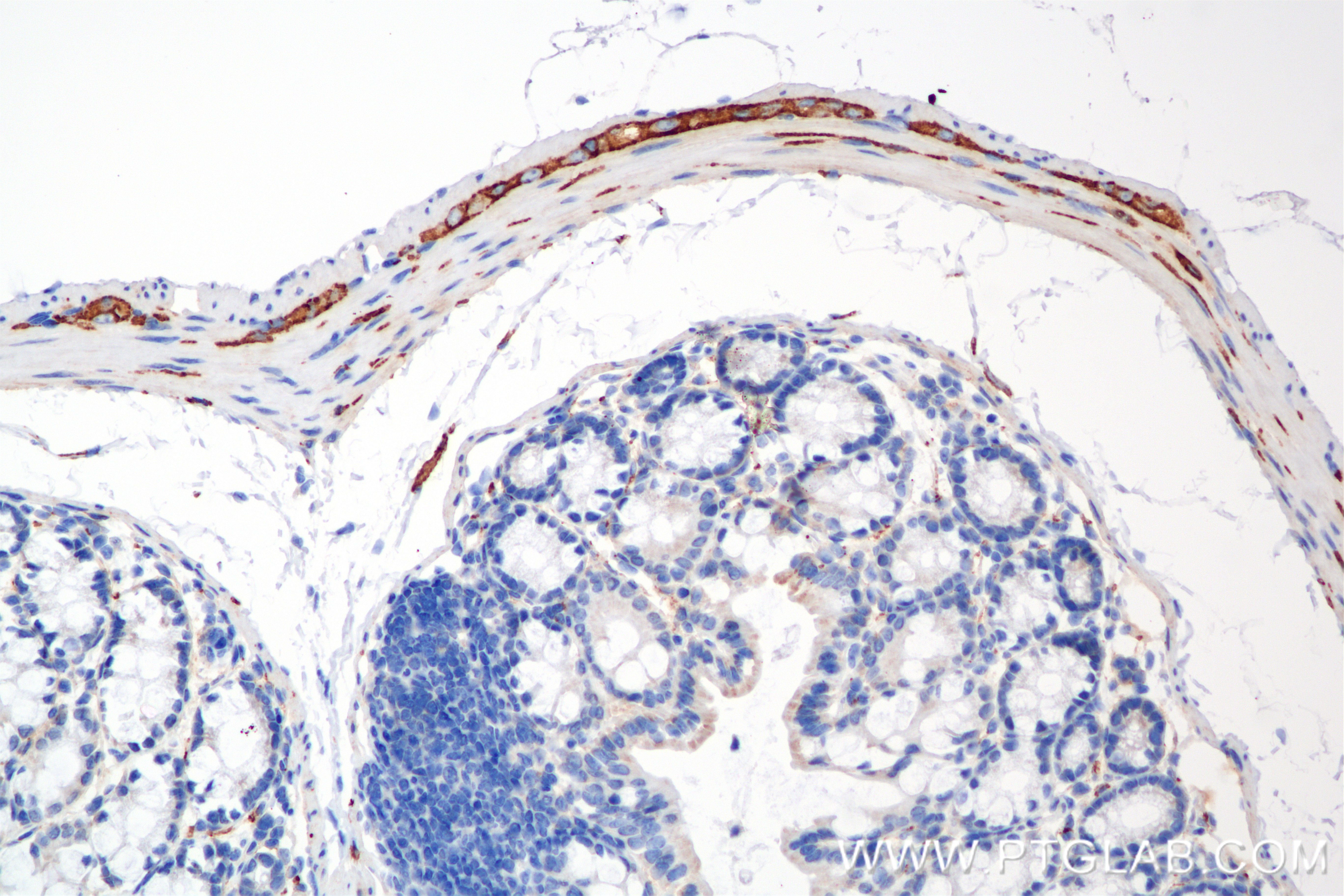 Immunohistochemistry (IHC) staining of mouse colon tissue using NCAM1/CD56 Recombinant antibody (82715-1-RR)
