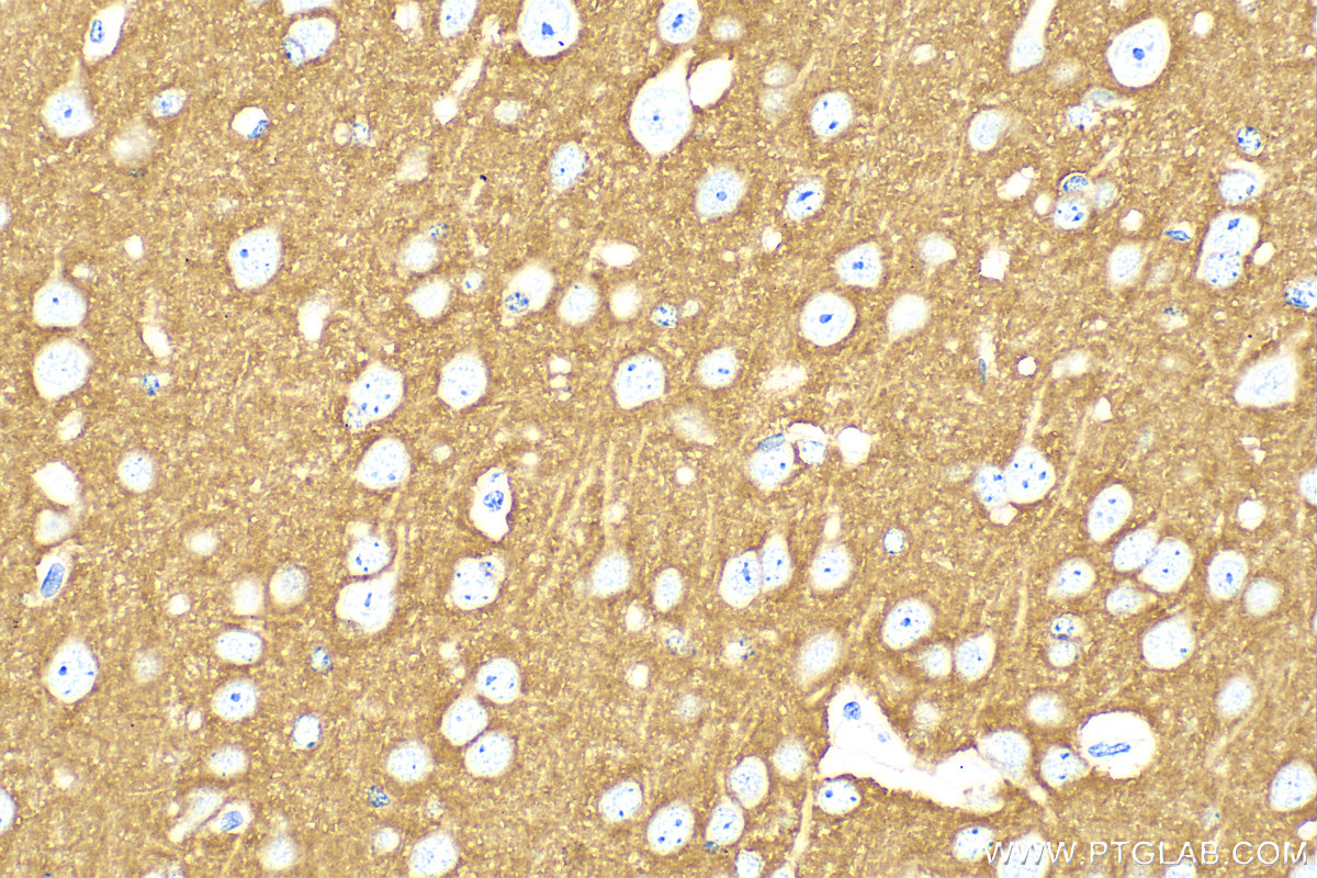 Immunohistochemistry (IHC) staining of mouse brain tissue using NCAM1/CD56 Polyclonal antibody (31536-1-AP)