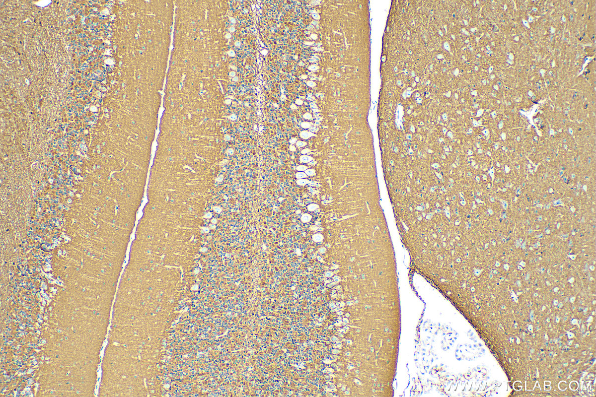 Immunohistochemistry (IHC) staining of mouse cerebellum tissue using NCAM1/CD56 Polyclonal antibody (31536-1-AP)