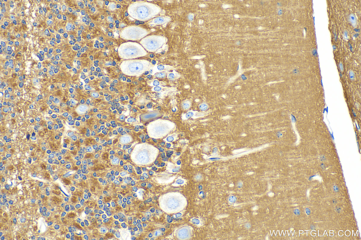 Immunohistochemistry (IHC) staining of mouse cerebellum tissue using NCAM1/CD56 Polyclonal antibody (31536-1-AP)