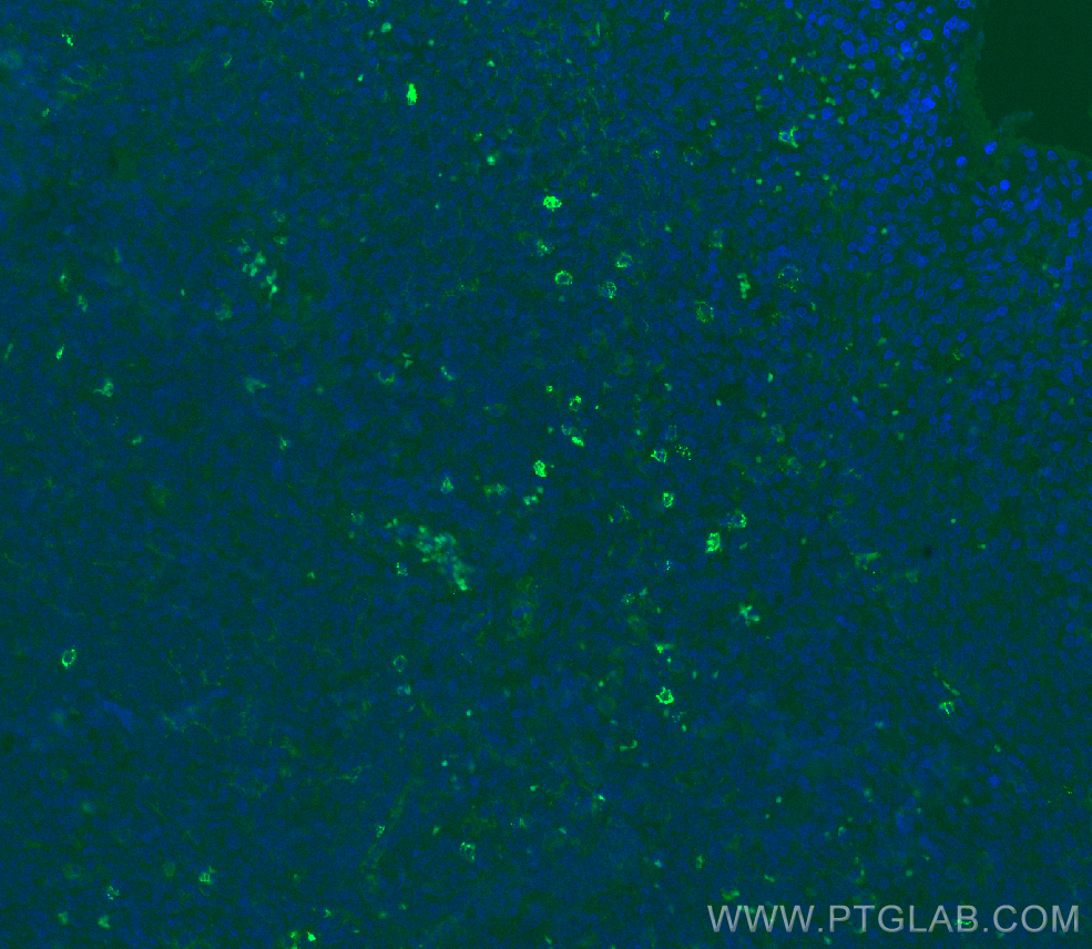 Immunofluorescence (IF) / fluorescent staining of human tonsillitis tissue using NCAM1/CD56 Recombinant antibody (82715-3-RR)