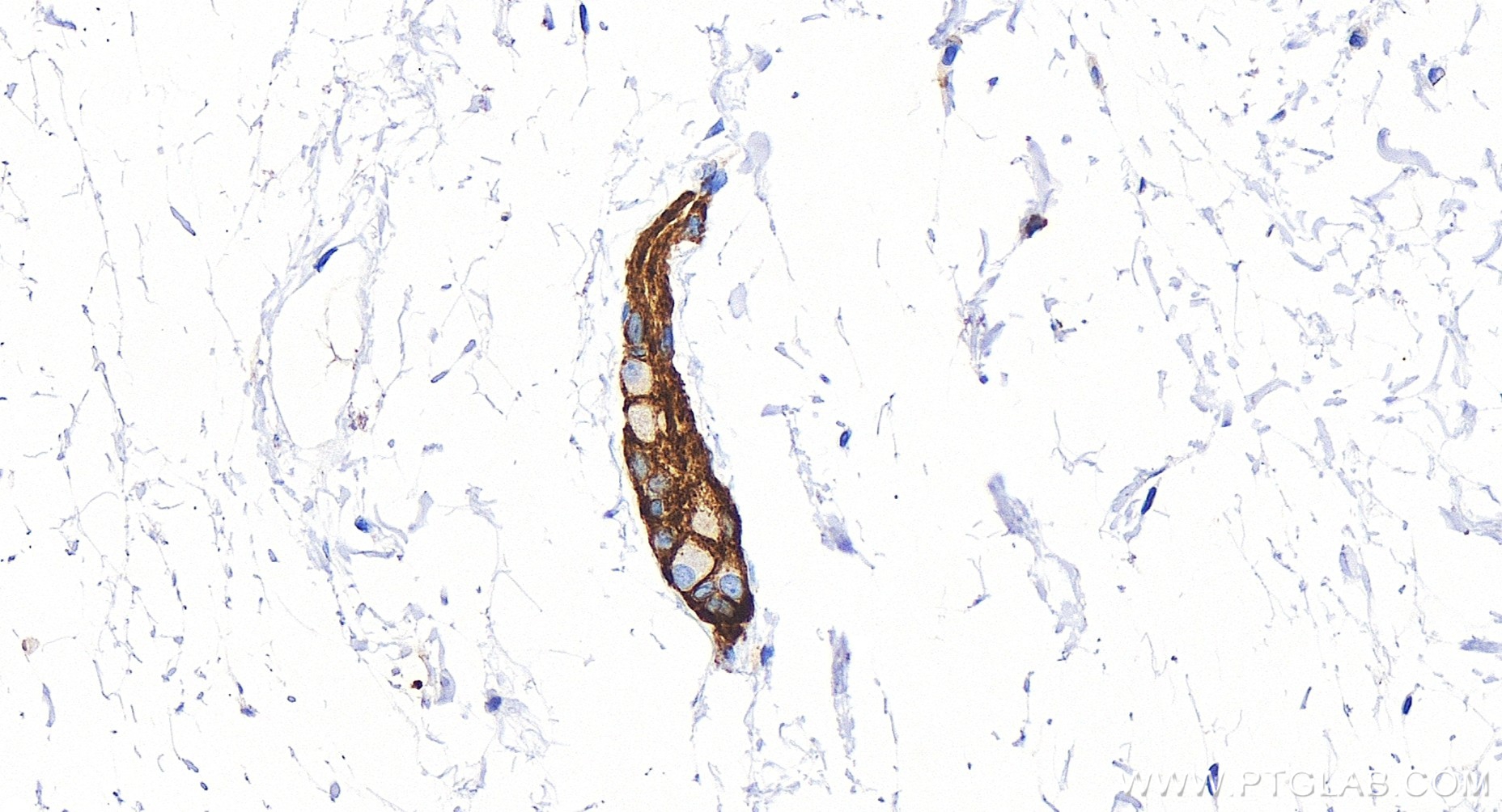 Immunohistochemistry (IHC) staining of human colon tissue using NCAM1/CD56 Recombinant antibody (83365-6-RR)