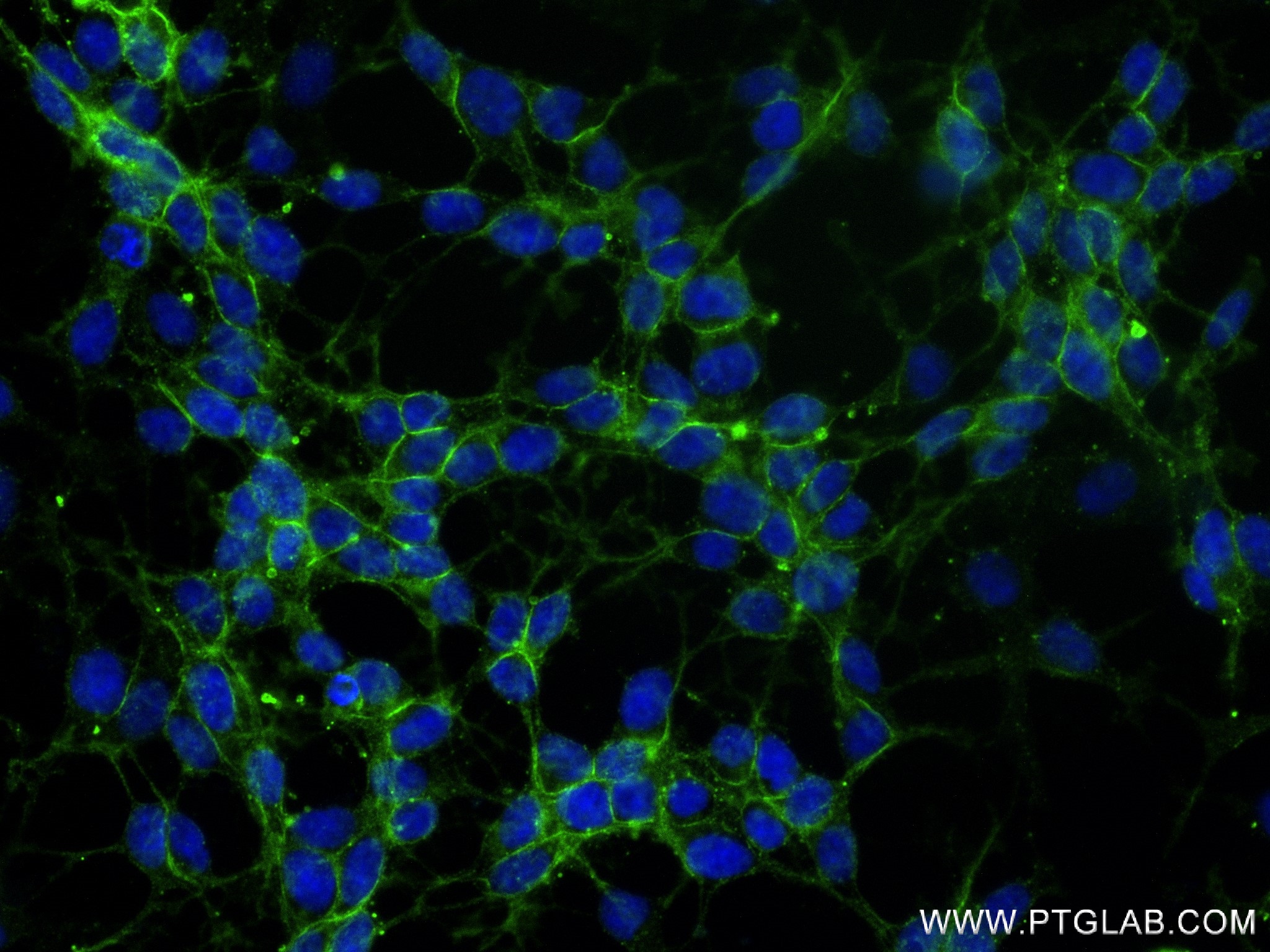 Immunofluorescence (IF) / fluorescent staining of SH-SY5Y cells using NCAM1/CD56 Recombinant antibody (83365-6-RR)