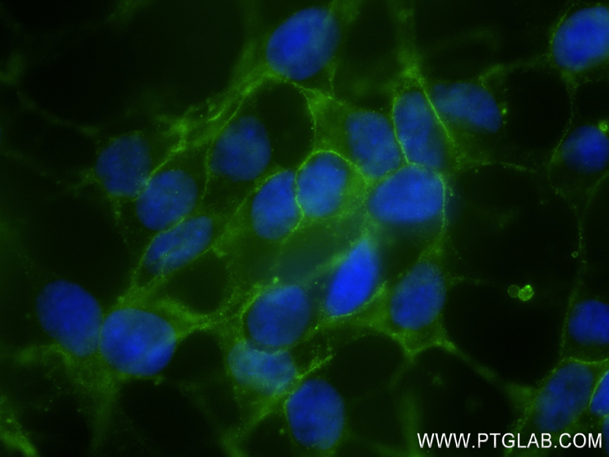 Immunofluorescence (IF) / fluorescent staining of SH-SY5Y cells using NCAM1/CD56 Recombinant antibody (83365-6-RR)