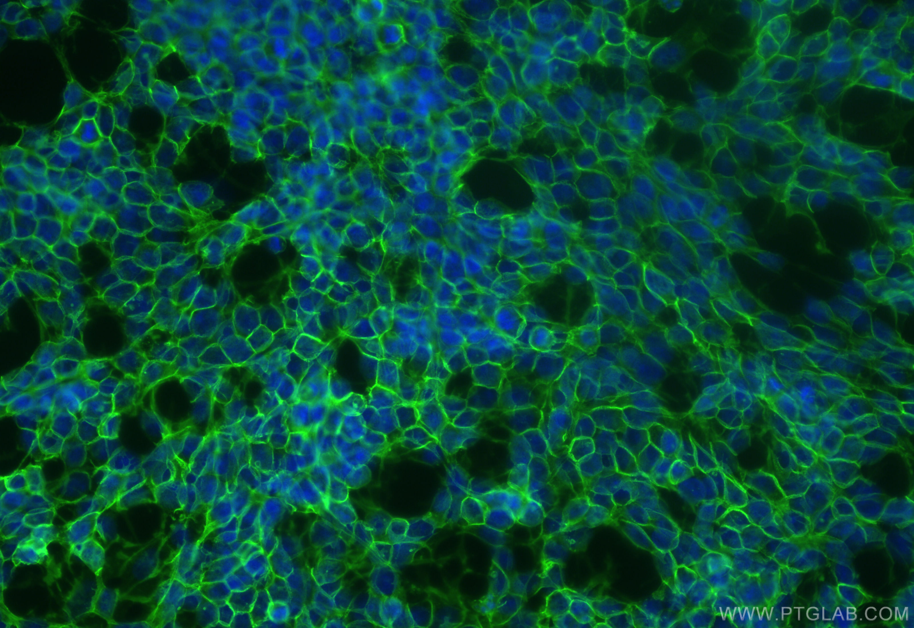 Immunofluorescence (IF) / fluorescent staining of SH-SY5Y cells using NCAM1/CD56 Recombinant antibody (83365-6-RR)