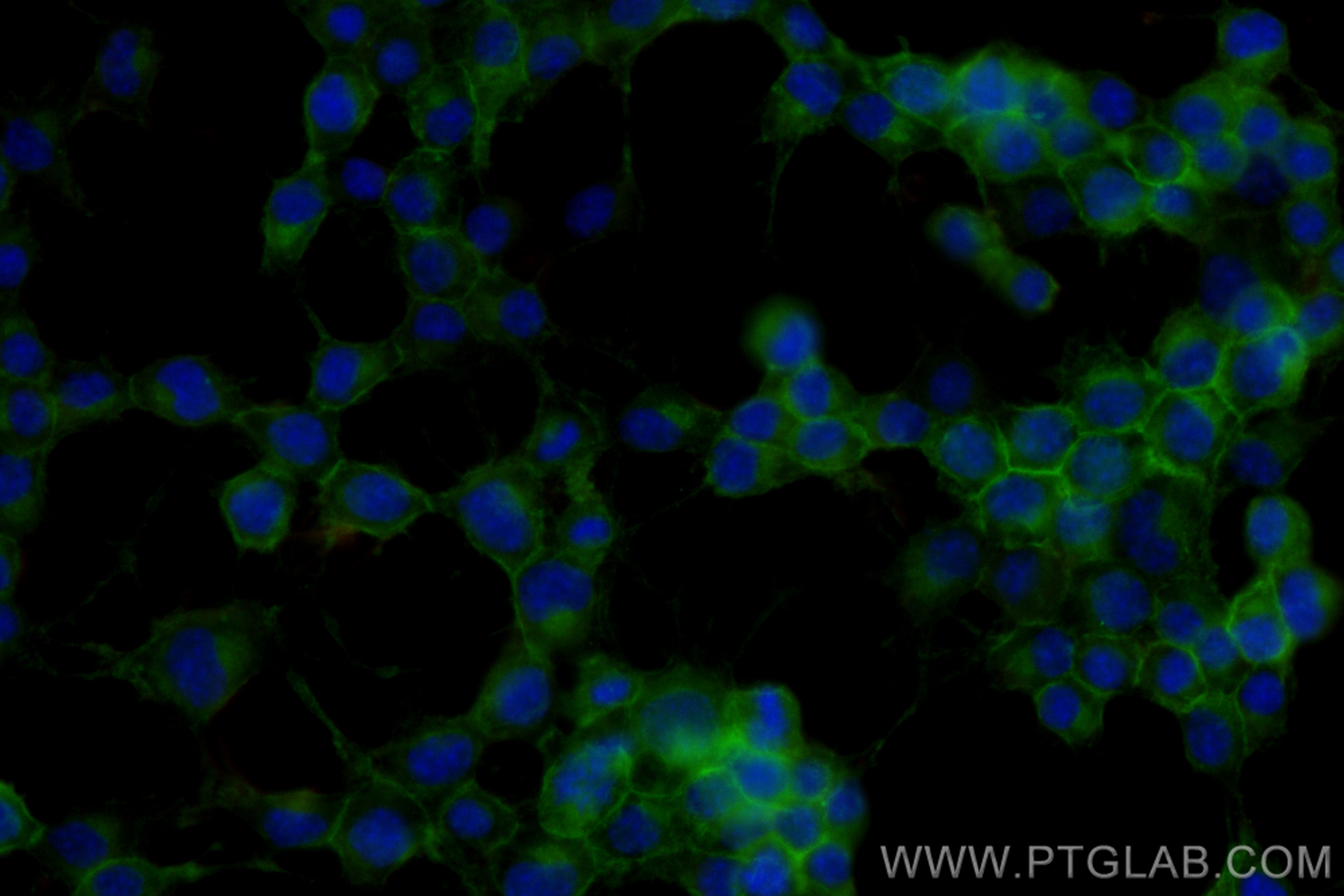 Immunofluorescence (IF) / fluorescent staining of Neuro-2a cells using CoraLite® Plus 488-conjugated NCAM1/CD56 Recombina (CL488-83883-5)