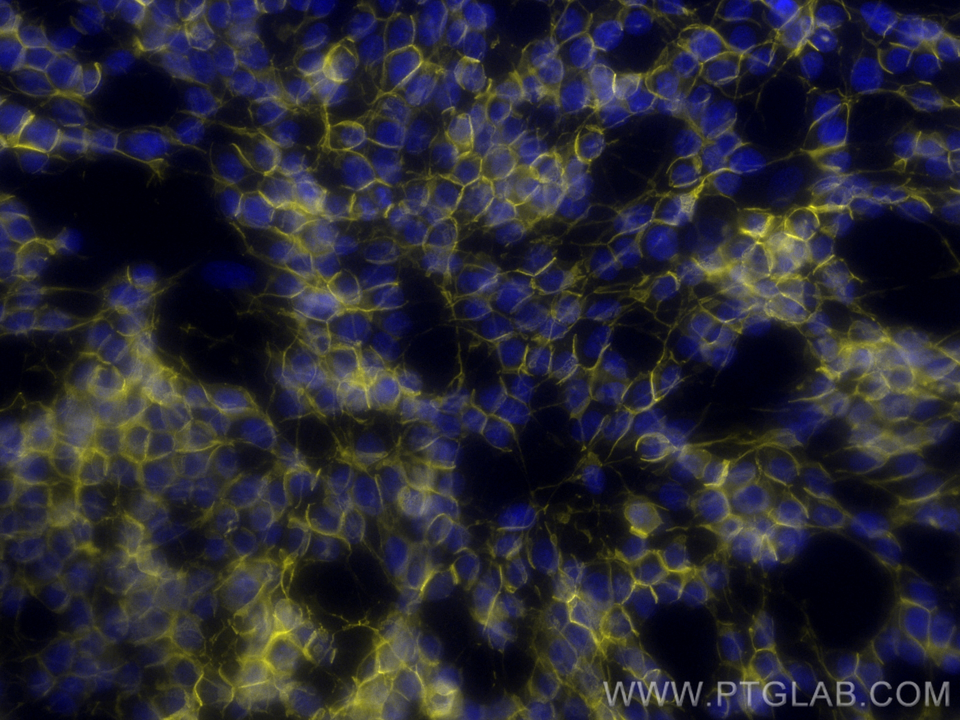 Immunofluorescence (IF) / fluorescent staining of SH-SY5Y cells using CoraLite®532-conjugated NCAM1/CD56 Recombinant ant (CL532-83365-6)