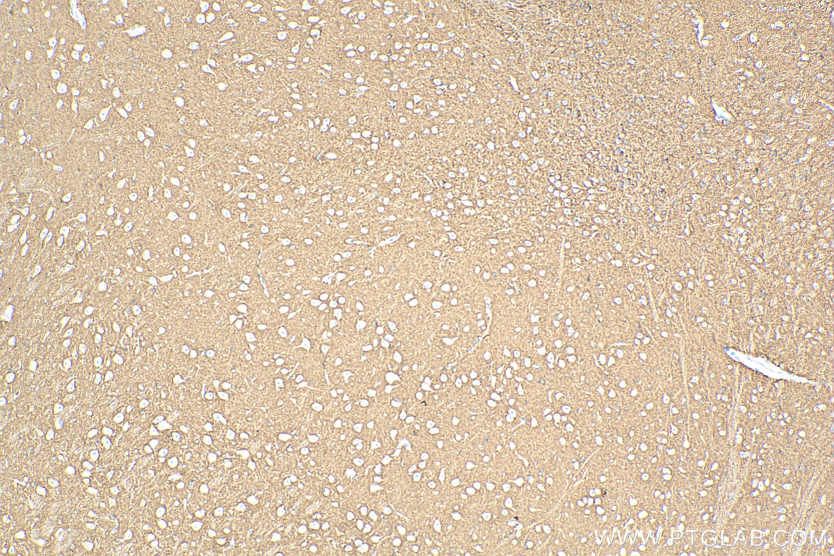 Immunohistochemistry (IHC) staining of mouse brain tissue using NCAM2 Polyclonal antibody (13850-1-AP)