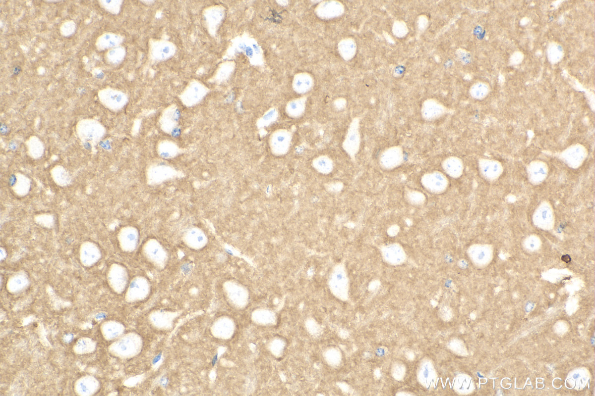 Immunohistochemistry (IHC) staining of mouse brain tissue using NCAM2 Polyclonal antibody (13850-1-AP)