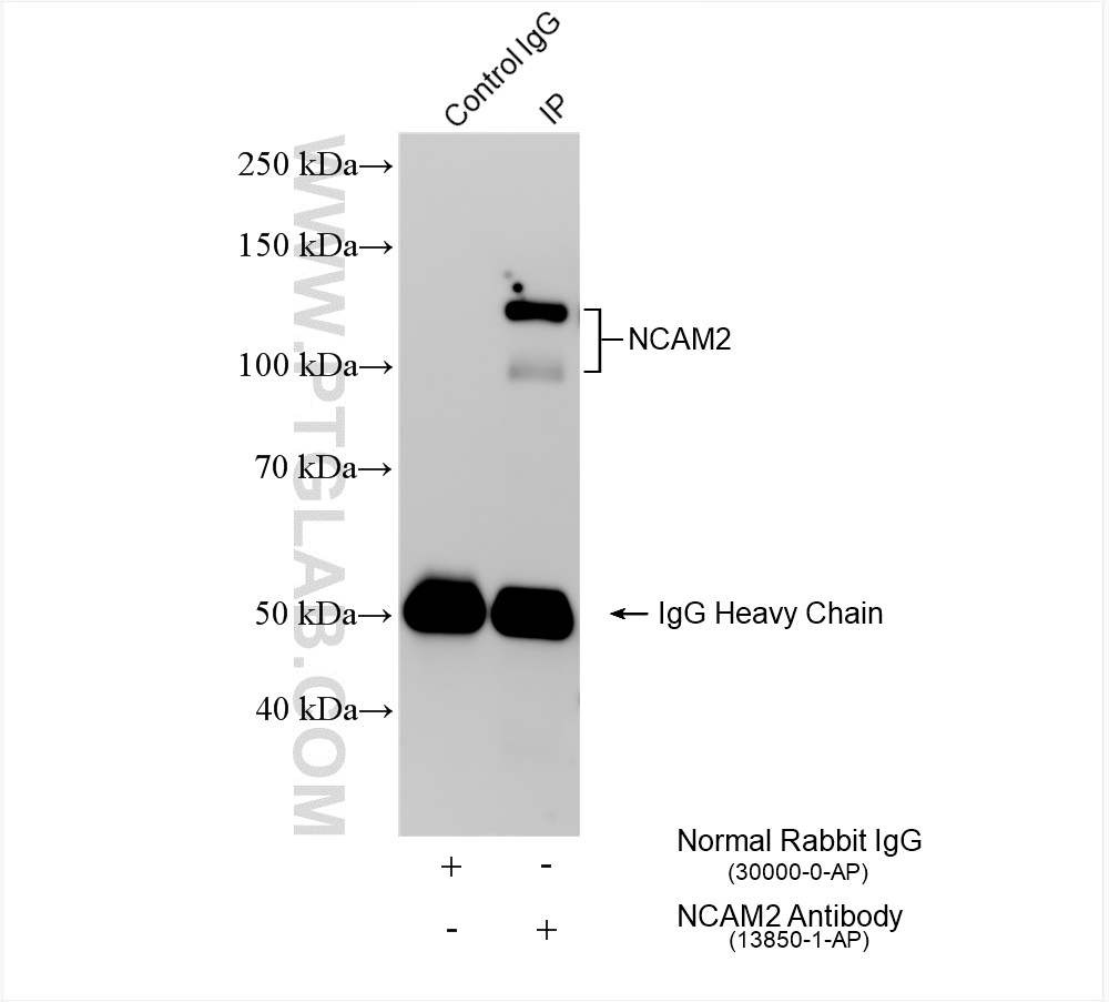 Immunoprecipitation (IP) experiment of mouse brain tissue using NCAM2 Polyclonal antibody (13850-1-AP)