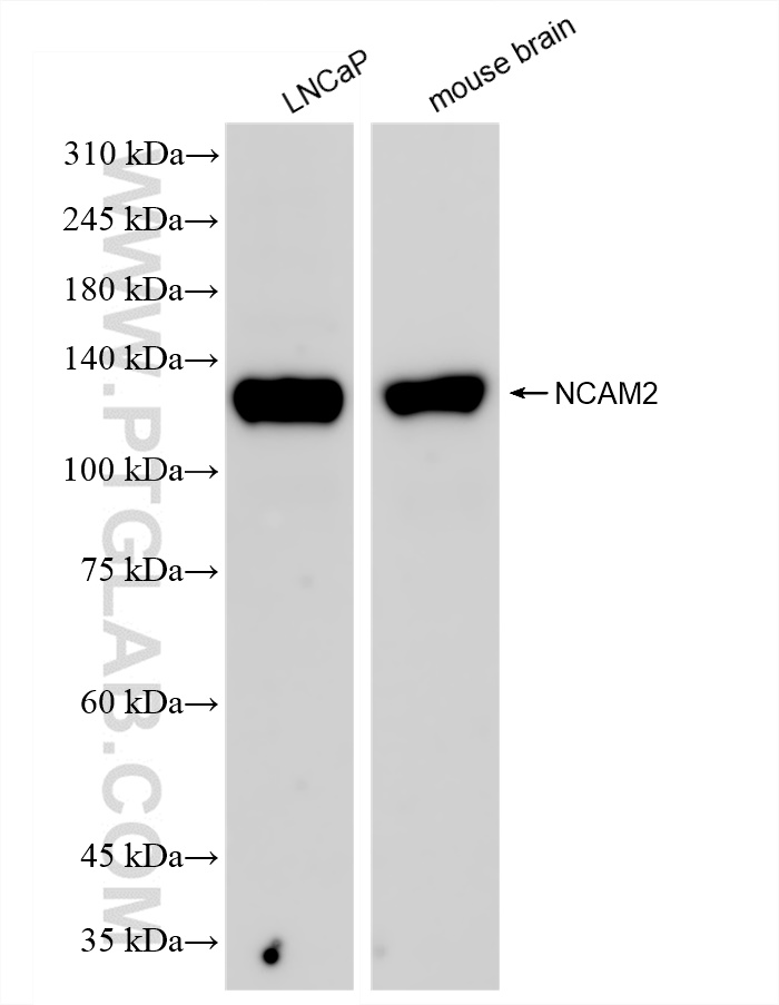 Western Blot (WB) analysis of various lysates using NCAM2 Recombinant antibody (83494-6-RR)