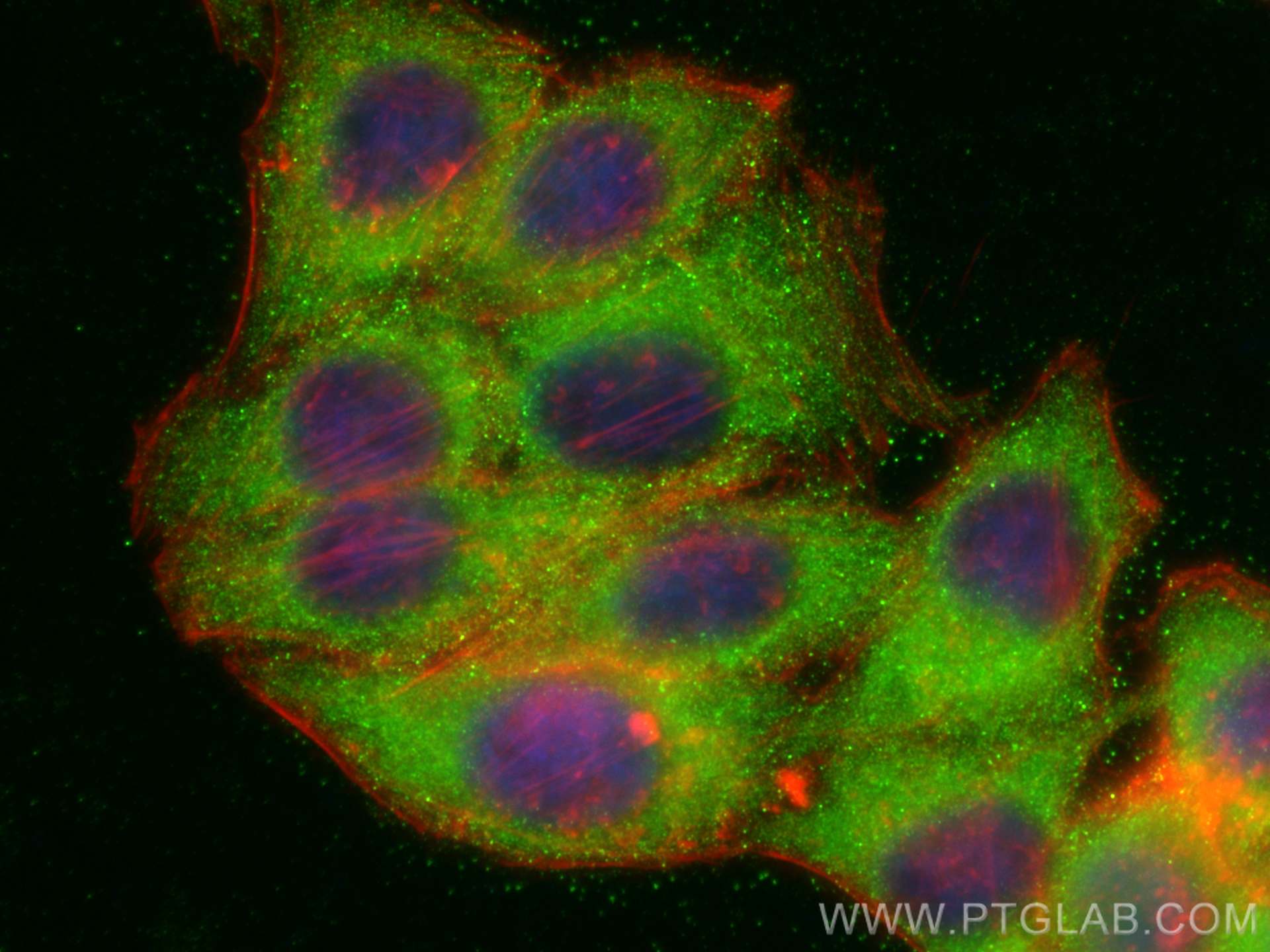 Immunofluorescence (IF) / fluorescent staining of HepG2 cells using NCAPG Polyclonal antibody (24563-1-AP)